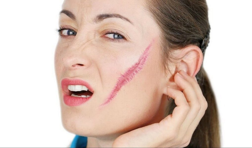 Советы: как убрать шрамы на лице у девушек